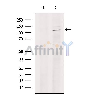 KDM4B / JMJD2B Antibody - Western blot analysis of extracts from B16F10 cells, using KDM4B / JMJD2B Antibody.