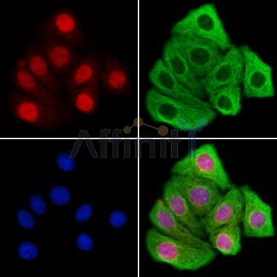 KDM4B / JMJD2B Antibody - DF13288 staining Hela cells by IF/ICC.
