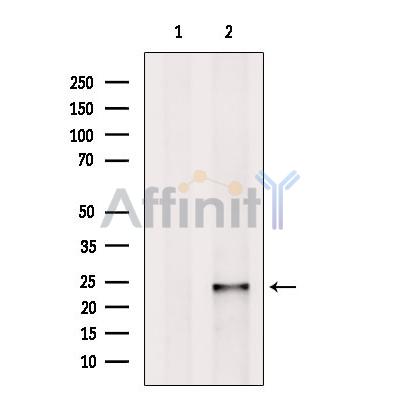 Rab4 Antibody - Western blot analysis of extracts from A2780 cells, using Rab4 Antibody.