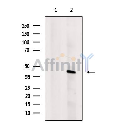 macroH2A.1 Antibody - Western blot analysis of extracts from Hela cells, using macroH2A.