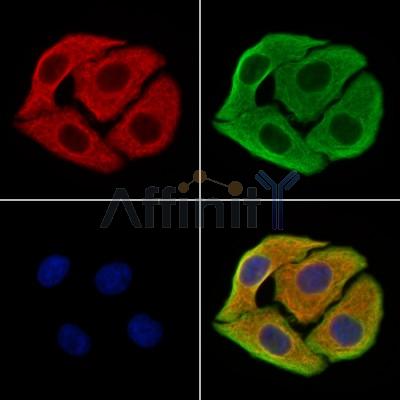 SAA2 Antibody - DF13301 staining Hela cells by IF/ICC.