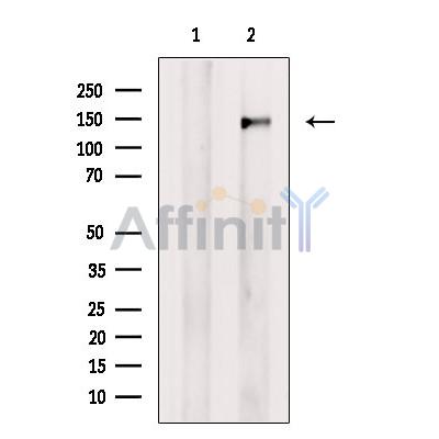 SMC2 Antibody - Western blot analysis of extracts from Hela cells, using SMC2 Antibody.