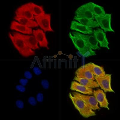 DPP9 - Catalytic domain Antibody - DF13332 staining Hela cells by IF/ICC.