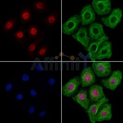 KIF17 Antibody - DF13337 staining Hela cells by IF/ICC.