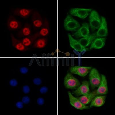 PHF8 Antibody - DF13341 staining Hela cells by IF/ICC.