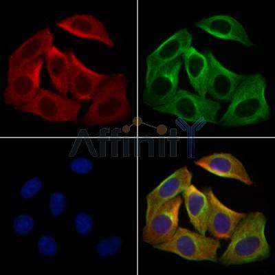KGF Antibody - DF13342 staining Hela cells by IF/ICC.