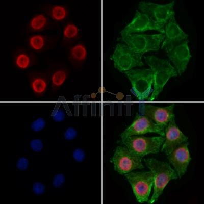 RBM3 Antibody - DF13353 staining Hela cells by IF/ICC.