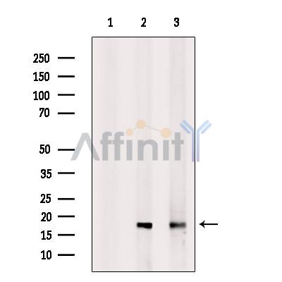 RBM3 Antibody - Western blot analysis of extracts from various samples, using RBM3 Antibody.