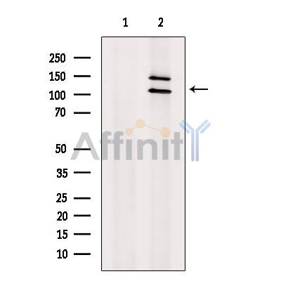 MSH4 Antibody - Western blot analysis of extracts from K562, using MSH4 Antibody.