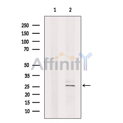 Nociceptin Antibody - Western blot analysis of extracts from Rat  brain, using Nociceptin Antibody.