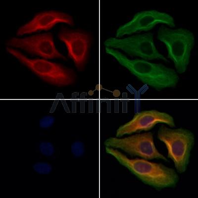 Nociceptin Antibody - DF13385 staining Hela cells by IF/ICC.
