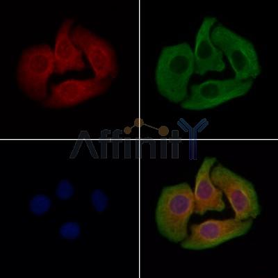 PP2C alpha Antibody - DF13395 staining Hela cells by IF/ICC.