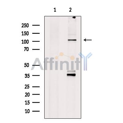 alpha 1 Spectrin Antibody - Western blot analysis of extracts from 3T3, using alpha 1 Spectrin Antibody.