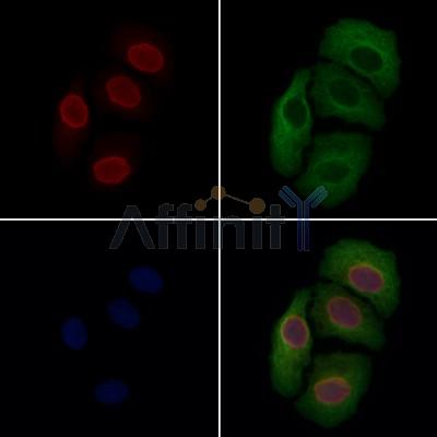 MUM1 Antibody - DF13418 staining Hela cells by IF/ICC.