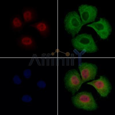 hFANCI Antibody - DF13422 staining Hela cells by IF/ICC.
