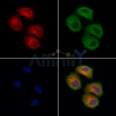 TOM1L2 Antibody - DF13443 staining Hela cells by IF/ICC.