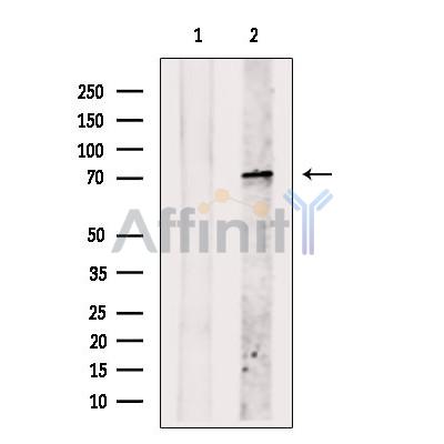T Plastin Antibody - Western blot analysis of extracts from Myeloma cells, using T Plastin Antibody.