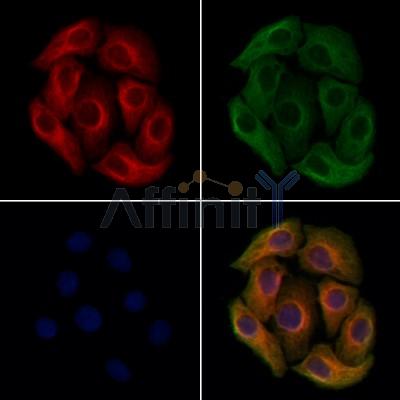 T Plastin Antibody - DF13459 staining Hela cells by IF/ICC.