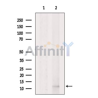 DIRC1 Antibody - Western blot analysis of extracts from HepG2 cells, using DIRC1 Antibody.