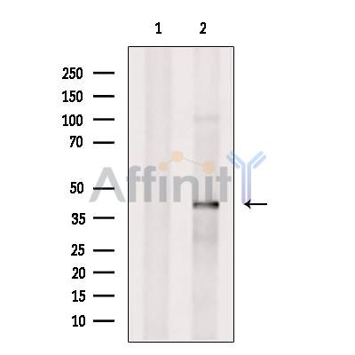 SLC35C2 Antibody - Western blot analysis of extracts from EC304, using SLC35C2 Antibody.