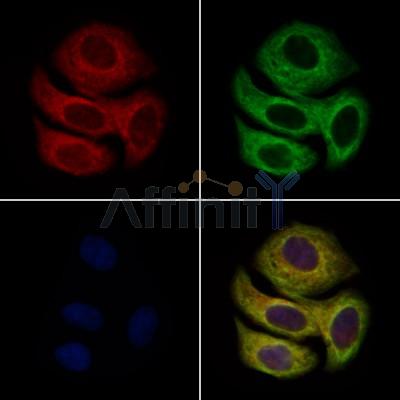 C10orf63 Antibody - DF2906 staining Hela cells by IF/ICC.
