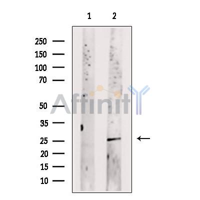 UCHL3 Antibody - Western blot analysis of extracts from MDA-MB231, using UCHL3 Antibody.