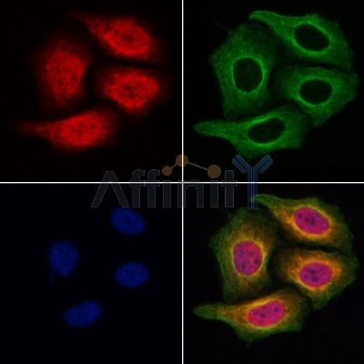 KIF4A Antibody - DF3941 staining Hela cells by IF/ICC.