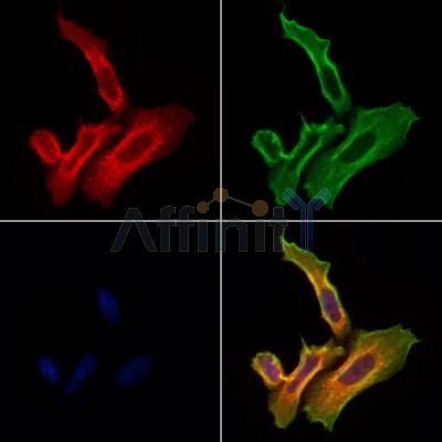 RHOB Antibody - DF4438 staining HepG2 cells by IF/ICC.
