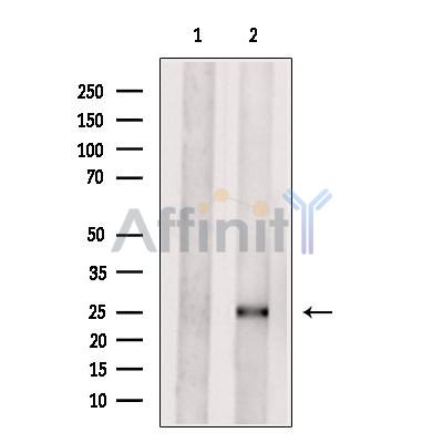 CRP Antibody - Western blot analysis of extracts from VERO cells, using CRP Antibody.