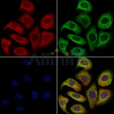 CRP Antibody - DF6027 staining Hela cells by IF/ICC.