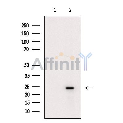 IL18 Antibody - Western blot analysis of extracts from Hela cells, using IL18 Antibody.