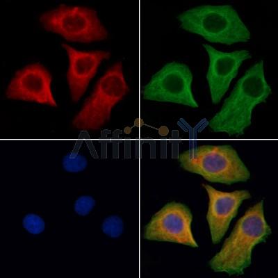ATP6AP1 Antibody - DF6341 staining Hela cells by IF/ICC.