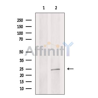 MAD2L1 Antibody - Western blot analysis of extracts from Hela cells, using MAD2L1 Antibody.