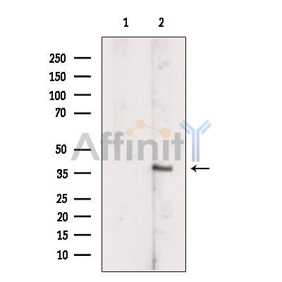 SCCPDH Antibody - Western blot analysis of extracts from Rat  muscle, using SCCPDH Antibody.