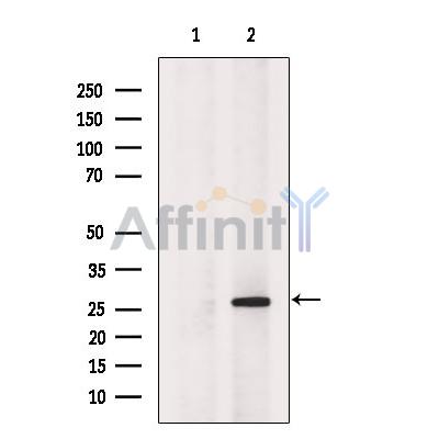 HDGF Antibody - Western blot analysis of extracts from VERO cells, using HDGF Antibody.