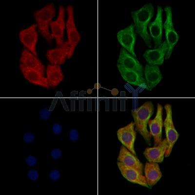 IRG1 Antibody - DF7723 staining Hela cells by IF/ICC.