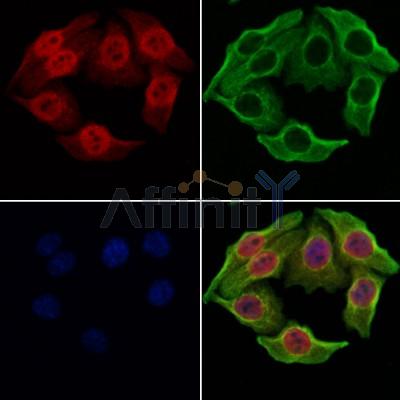 Sall4 Antibody - DF7757 staining Hela cells by IF/ICC.