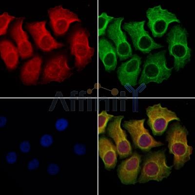 MUC16 Antibody - DF7989 staining Hela cells by IF/ICC.