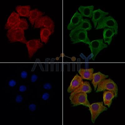 CD3G Antibody - DF8098 staining Hela cells by IF/ICC.
