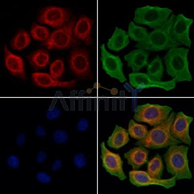 CD163 Antibody - DF8235 staining Hela cells by IF/ICC.