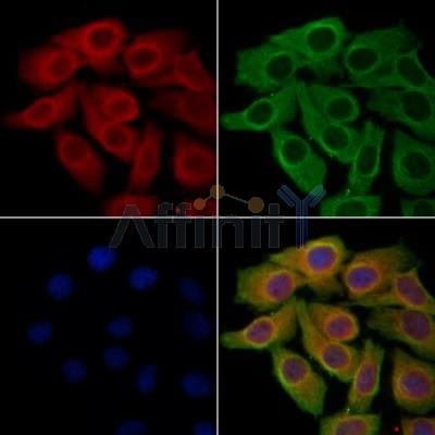 SIRT5 Antibody - DF8294 staining Hela cells by IF/ICC.