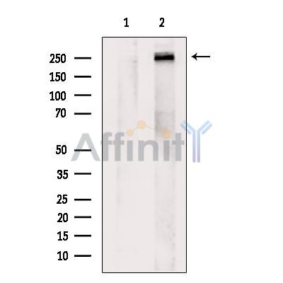 CELSR2 Antibody - Western blot analysis of extracts from Mouse  muscle, using CELSR2 Antibody.