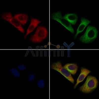 CELSR2 Antibody - DF8912 staining Hela cells by IF/ICC.
