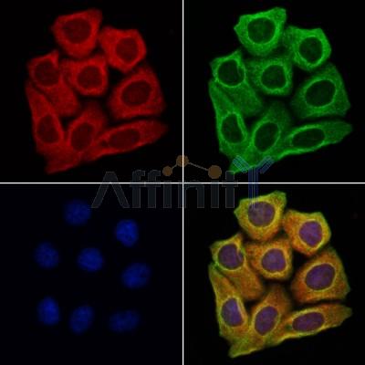 AQP9 Antibody - DF9225 staining Hela cells by IF/ICC.