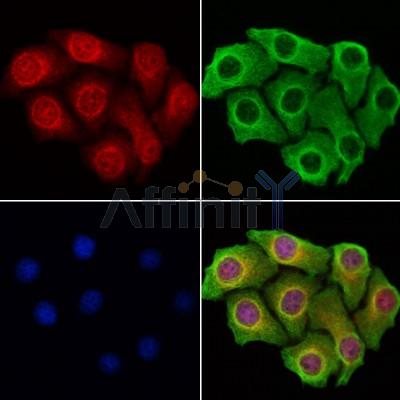 BCCIP Antibody - DF9290 staining Hela cells by IF/ICC.