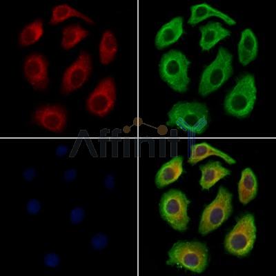 S100A7 Antibody - DF9783 staining Hela cells by IF/ICC.