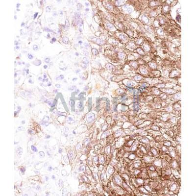 ABCA4 Antibody - DF9852 at 1/100 staining Mouse retina tissue sections by IHC-P.