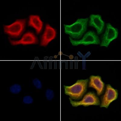 ULK4 Antibody - DF9891 staining Hela cells by IF/ICC.