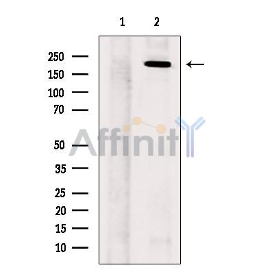 SCN11A Antibody - Western blot analysis of extracts from Hela cells, using SCN11A Antibody.