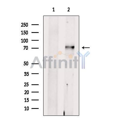 SLC24A2 Antibody - Western blot analysis of extracts from Rat  brain, using SLC24A2 Antibody.